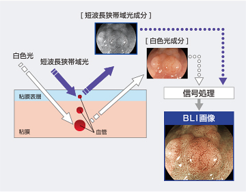 BLI画像