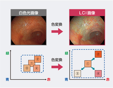 LCI画像